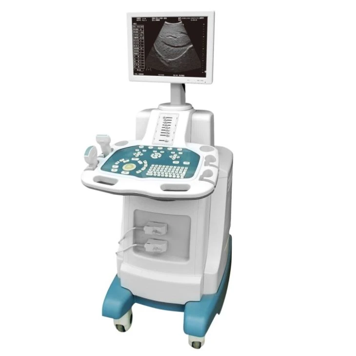 2D B/W Trolley Ultrasound Diagnosis System 2D B/W Trolley Ultrasound Diagnosis System