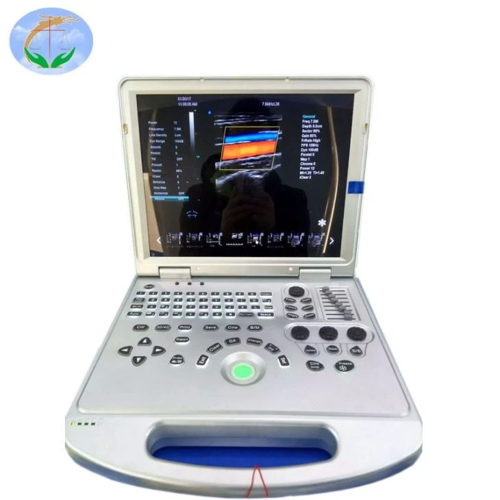 4D Trolley Full Digital Scanner 4D Trolley Full Digital Scanner
