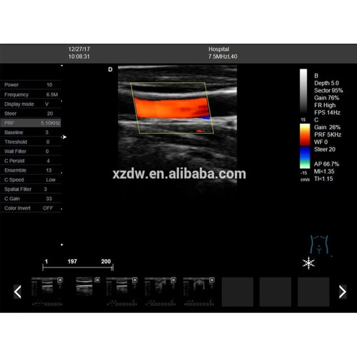 4D Trolley Full Digital Scanner 4D Trolley Full Digital Scanner