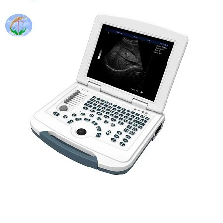 Full-Digital Laptop Ultrasound Scanner Full-Digital Laptop Ultrasound Scanner