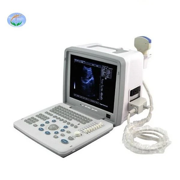 Sħiħ Digital LED Portable Ultrasound