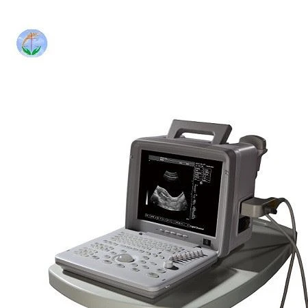 Full Digital LED Portable Ultrasound Full Digital LED Portable Ultrasound