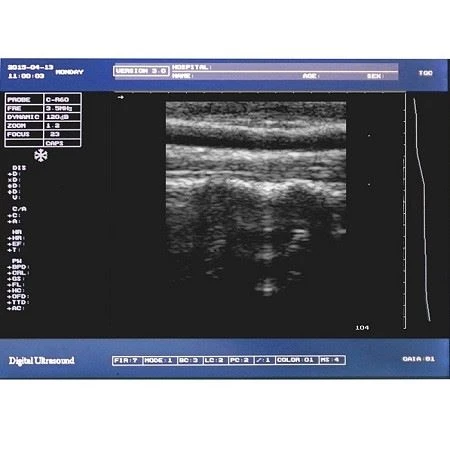 Full Digital LED Portable Ultrasound Full Digital LED Portable Ultrasound