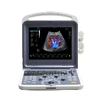 Kompletament Diġitali Ultrasound Kulur Doppler Ultrasound Magni Prezz