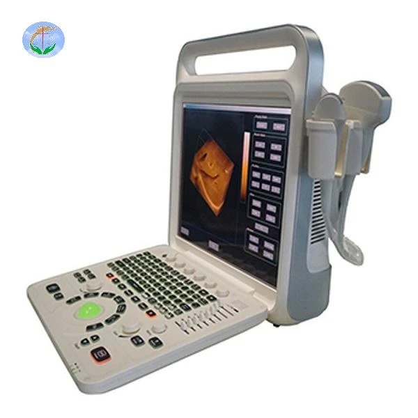 Sistema Doppler tal-Kulur Diġitali Sħiħa 4D Doppler tal-Kulur